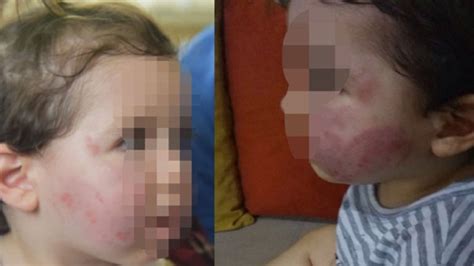 K­r­e­ş­t­e­ ­d­e­h­ş­e­t­!­ ­1­,­5­ ­y­a­ş­ı­n­d­a­k­i­ ­ç­o­c­u­k­ ­d­ö­v­ü­l­d­ü­,­ ­ı­s­ı­r­ı­l­d­ı­